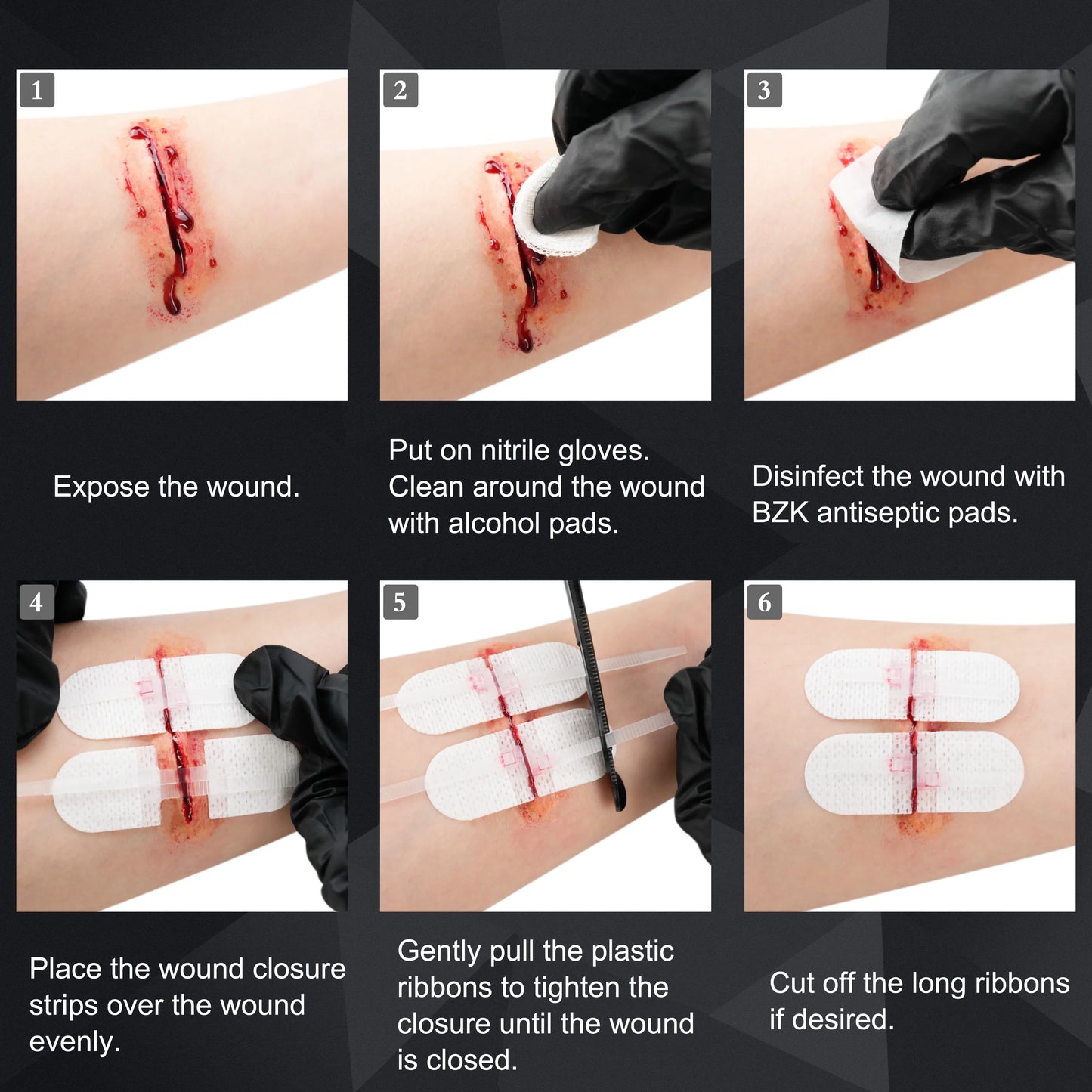 RHINO RESCUE Zip Stitch 6pcs with Wound Dresssings, Wound Closure Strips, Zipstitch Laceration Closure Kit for Cut Care Band-aid