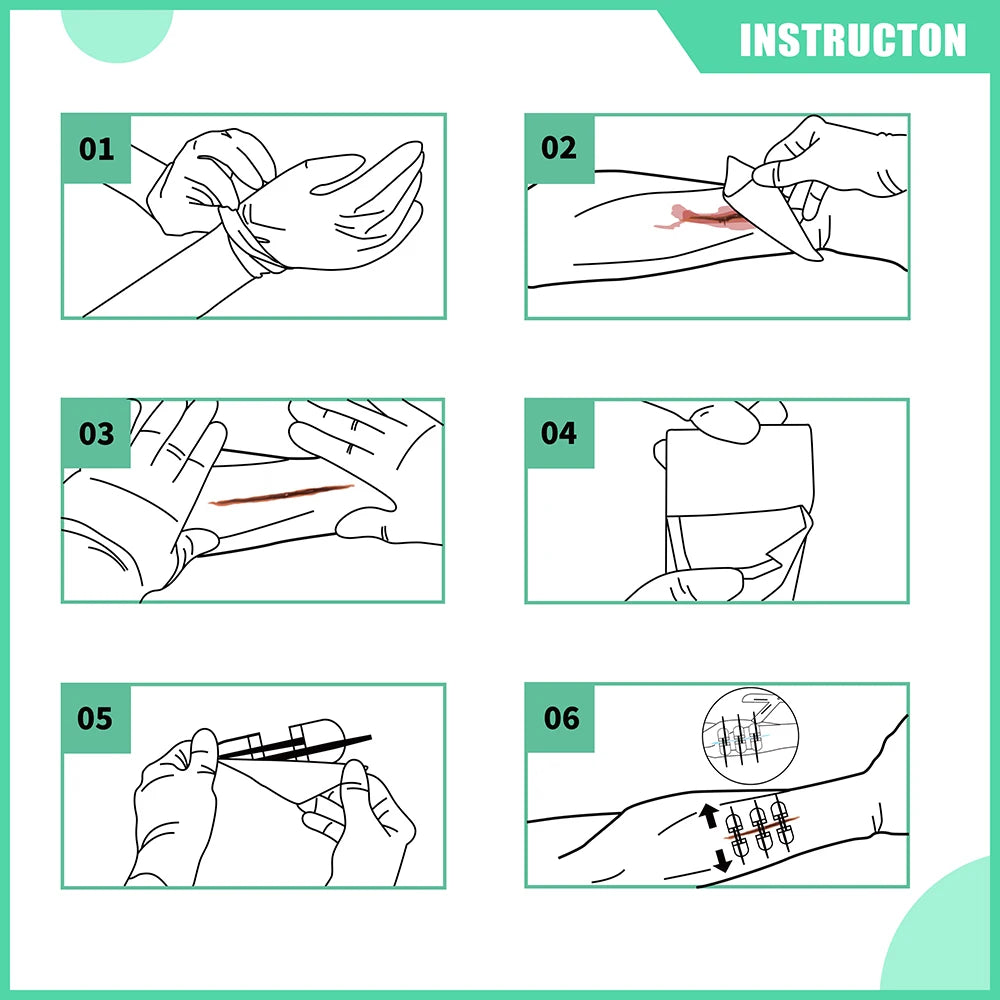 RHINO RESCUE Zip Stitch 6pcs with Wound Dresssings, Wound Closure Strips, Zipstitch Laceration Closure Kit for Cut Care Band-aid